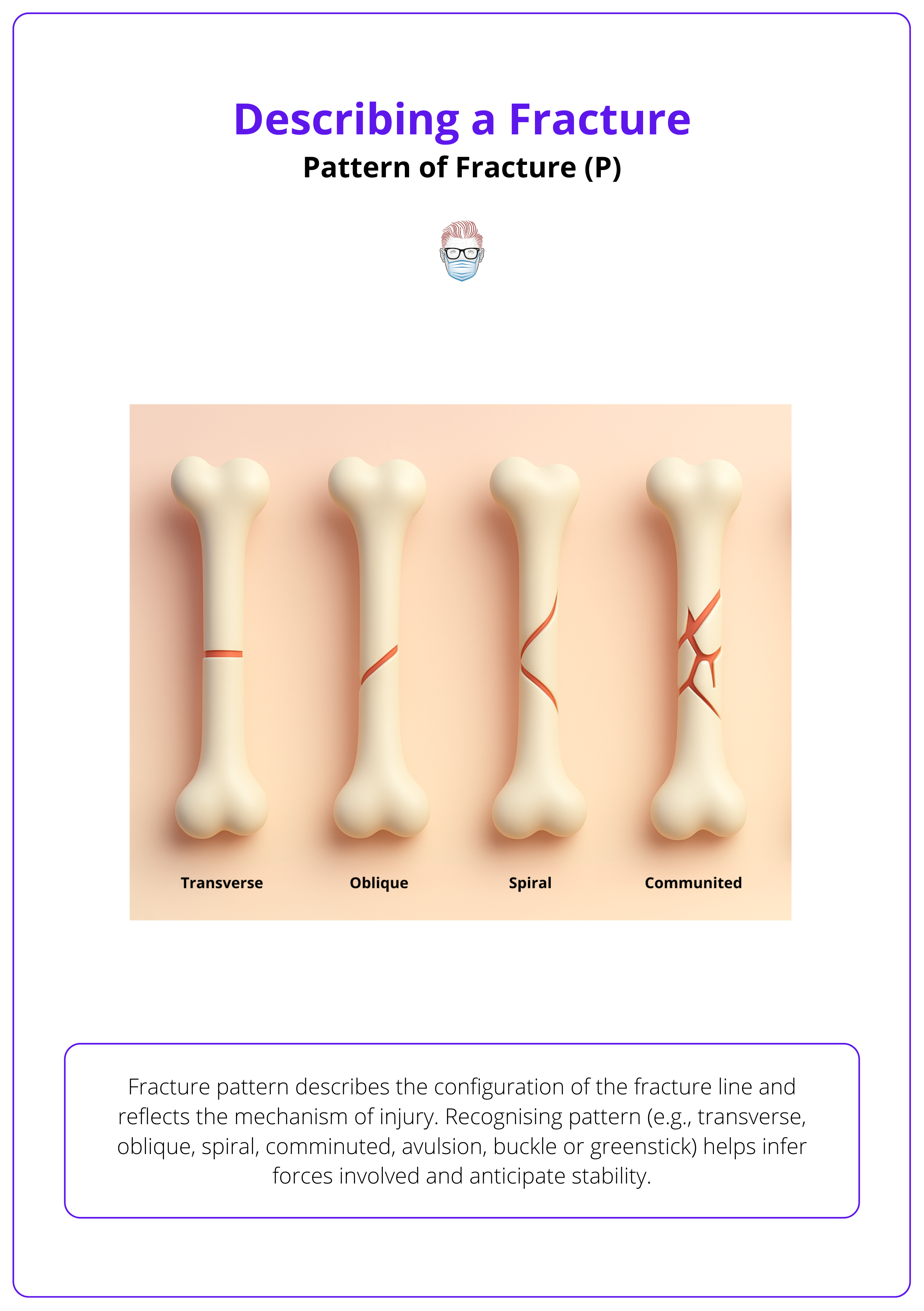 Key fracture patterns: Transverse, oblique, spiral, communited