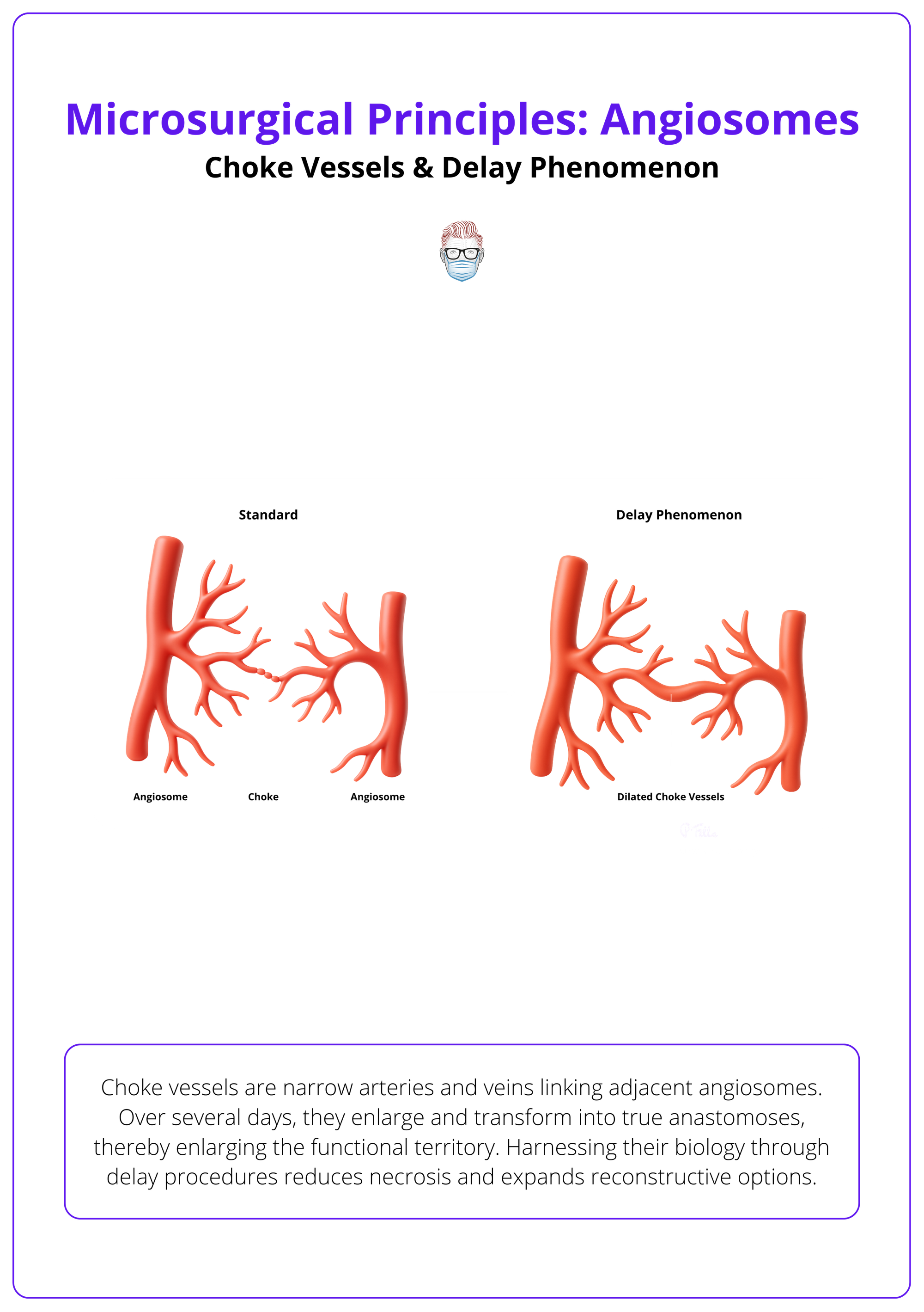 Choke vessels and the delay phenomenon, microsurgery