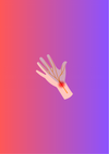 Radial Nerve Tendon Transfers: Principles, Anatomy, & Surgery