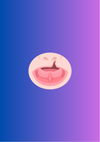 Cleft Palate: Anatomy, Classification, & Surgical Repair