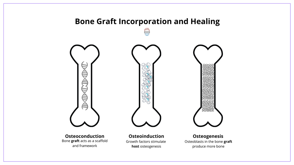 Bone Grafts