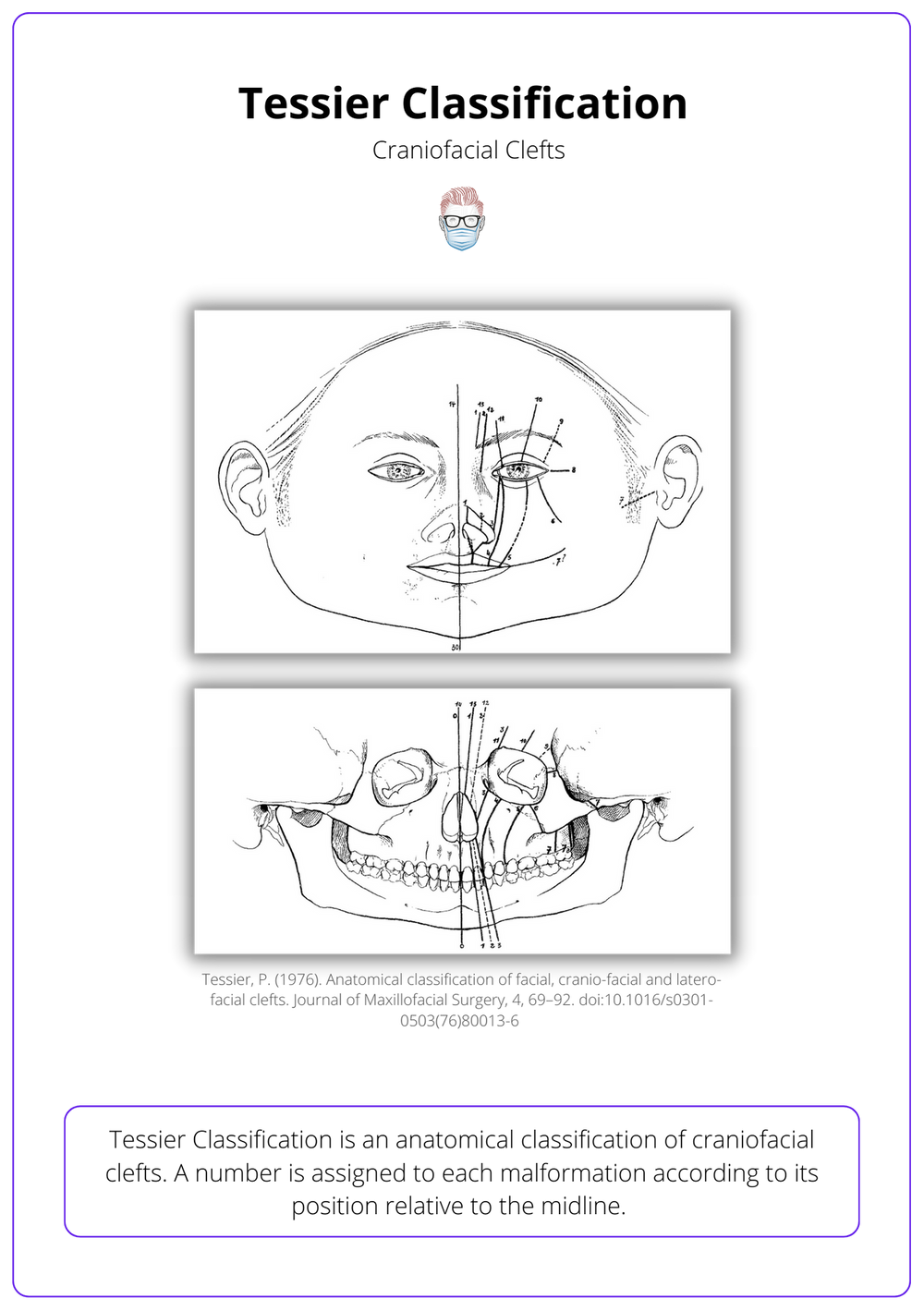 Craniofacial Clefts · Tessier Classification, Types, Management