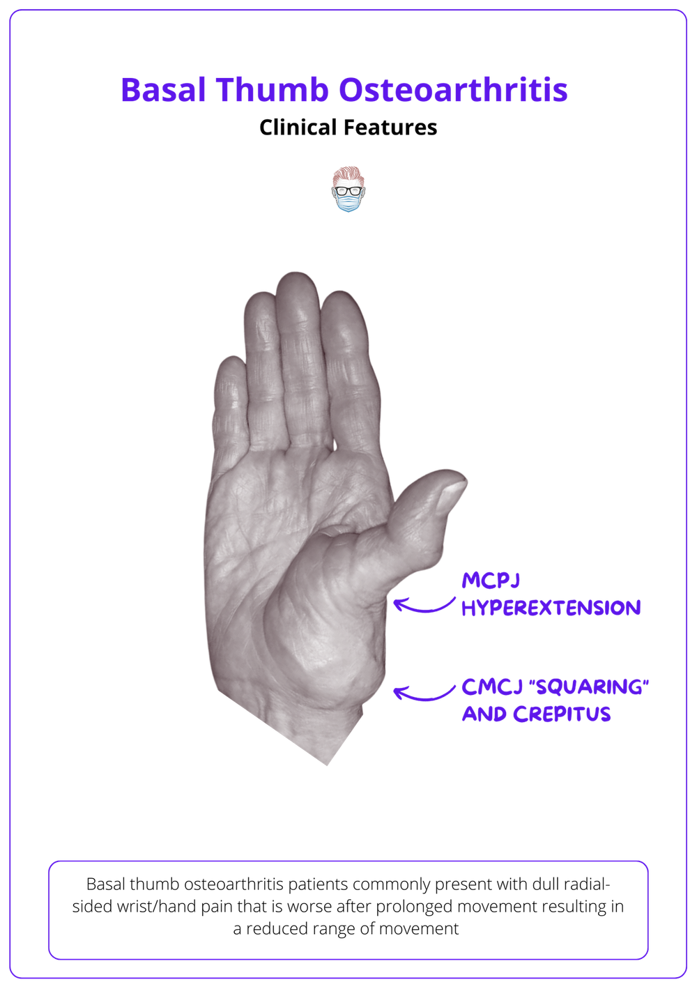 Basal Thumb Osteoarthritis Anatomy, Pathophysiology, Diagnosis, Treatment