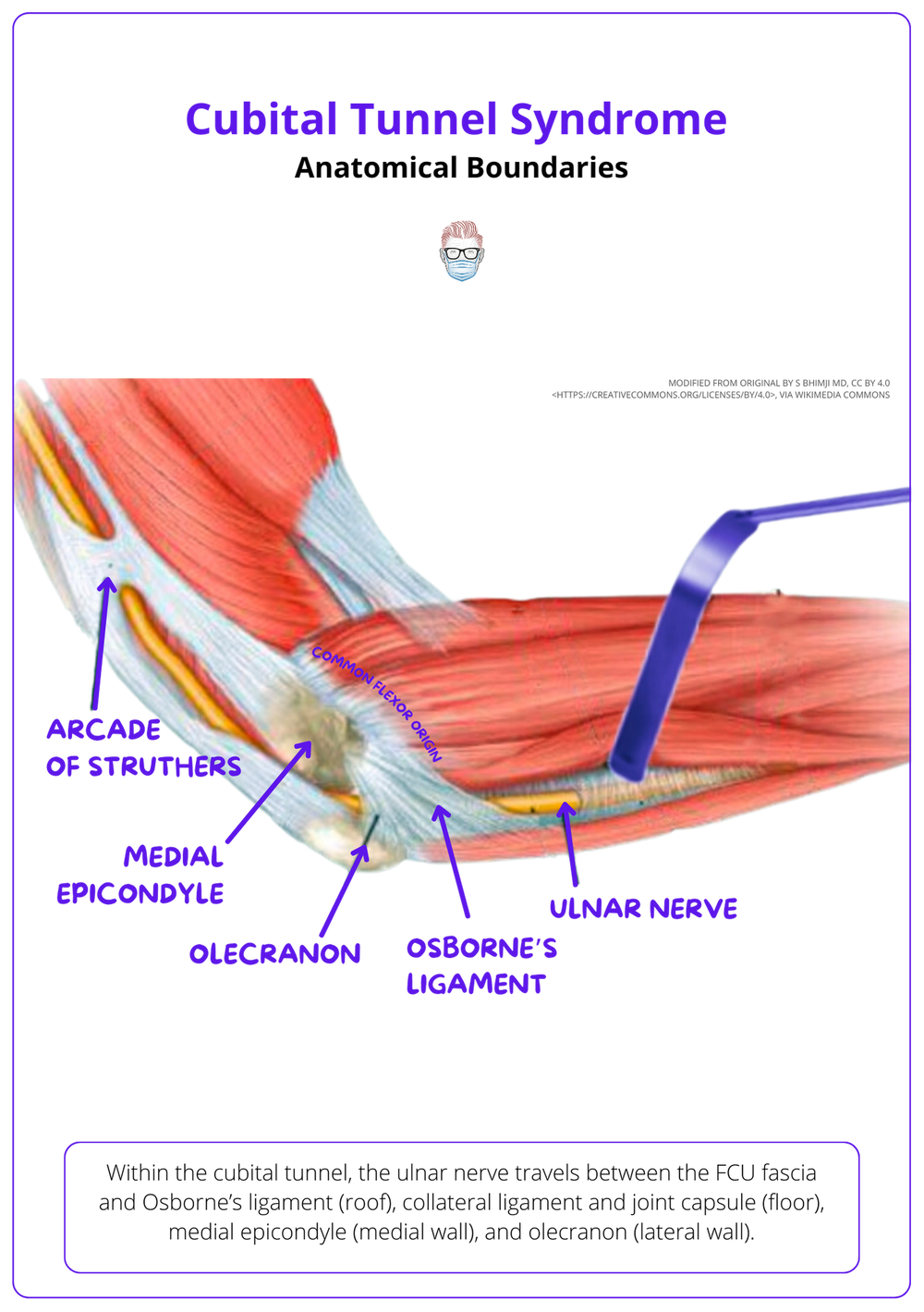Cubital Tunnel Syndrome Anatomy, Clinical Diagnosis, and Treatment Options