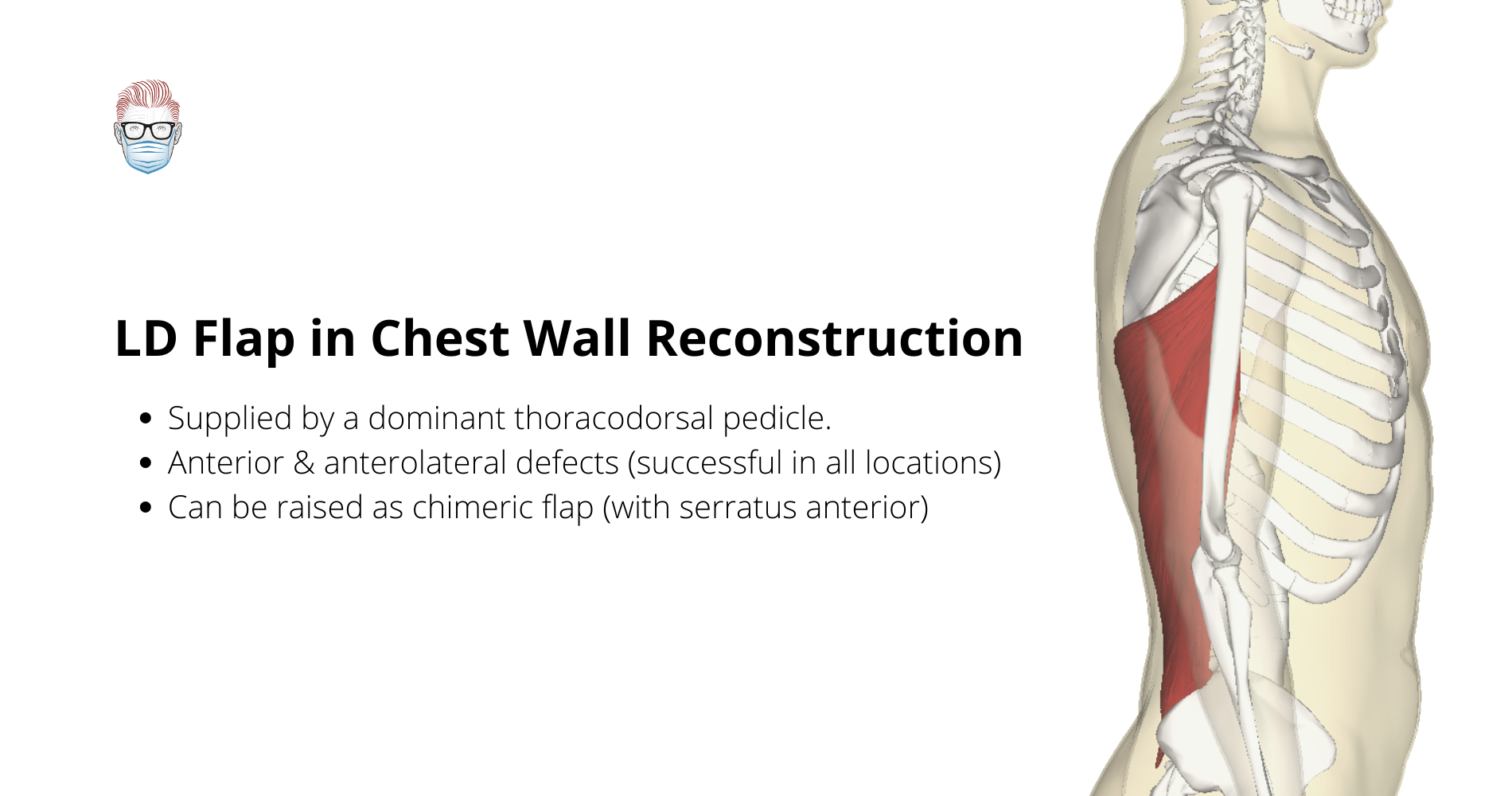 Principles of Chest Wall Reconstruction
