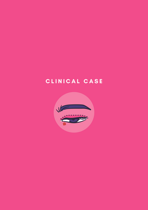 Periocular BCC - Clinical Case