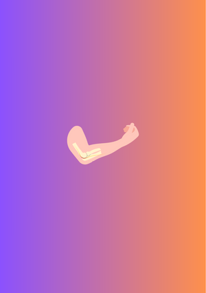 Cubital Tunnel Syndrome